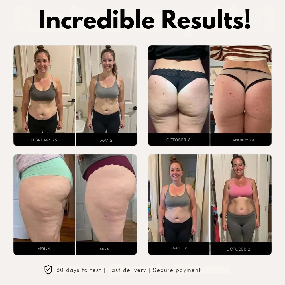 Cellu-X | 3D Metabolic Booster Leggings Shorts